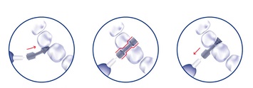 JORDAN CLINIC XS - Szczoteczki międzyzębowe 0,4 mm 10 szt